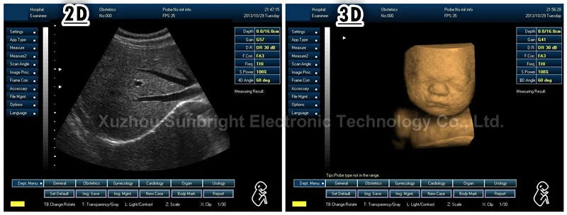 3D 4D VET ultra sound 15" color ultrasound equipment clear images USG machine