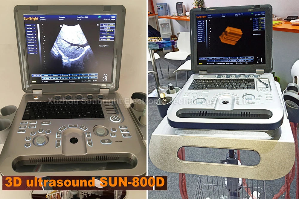 3D 4D VET ultra sound 15" color ultrasound equipment clear images USG machine